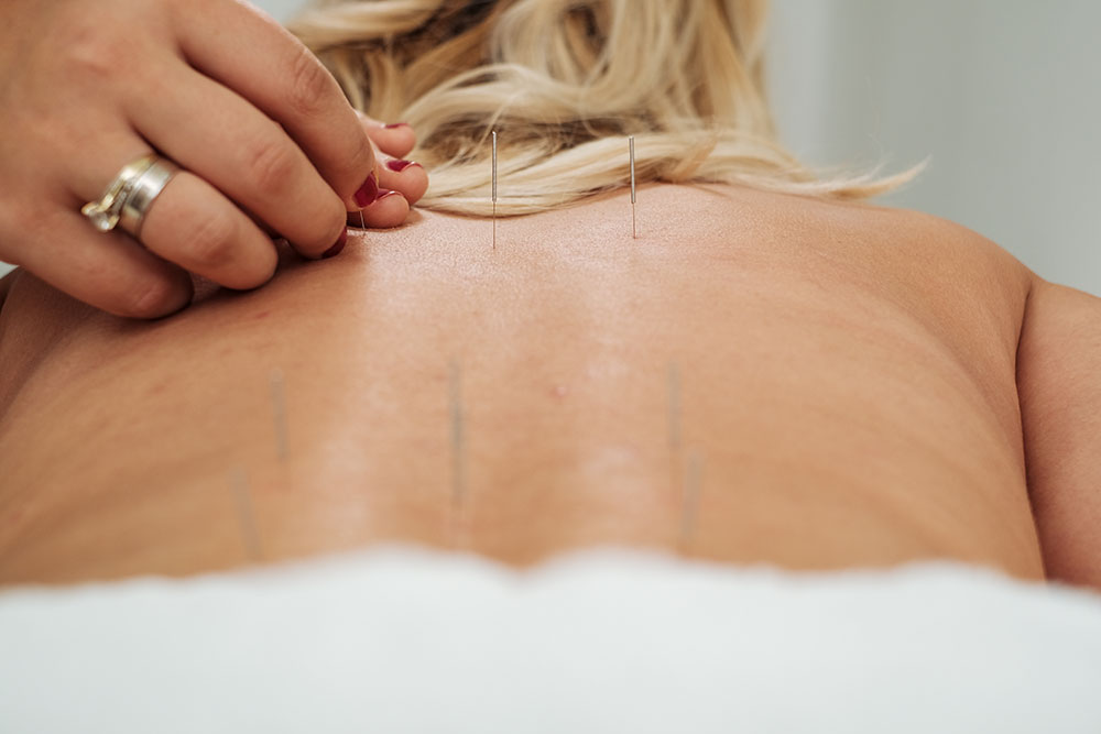 Akupunktura Longa Vita